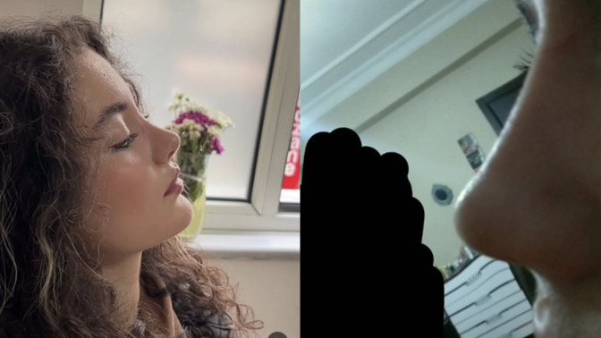 Doktor burnumu yanlış mı yapmış?
