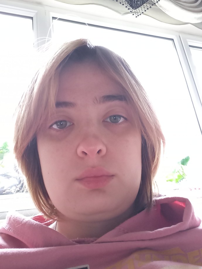 Göz altı morluğum çok mu?