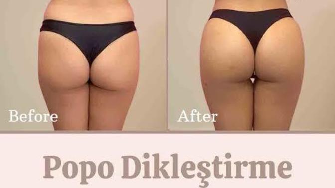 Kalça kaldırma egzersizleri nelerdir?
