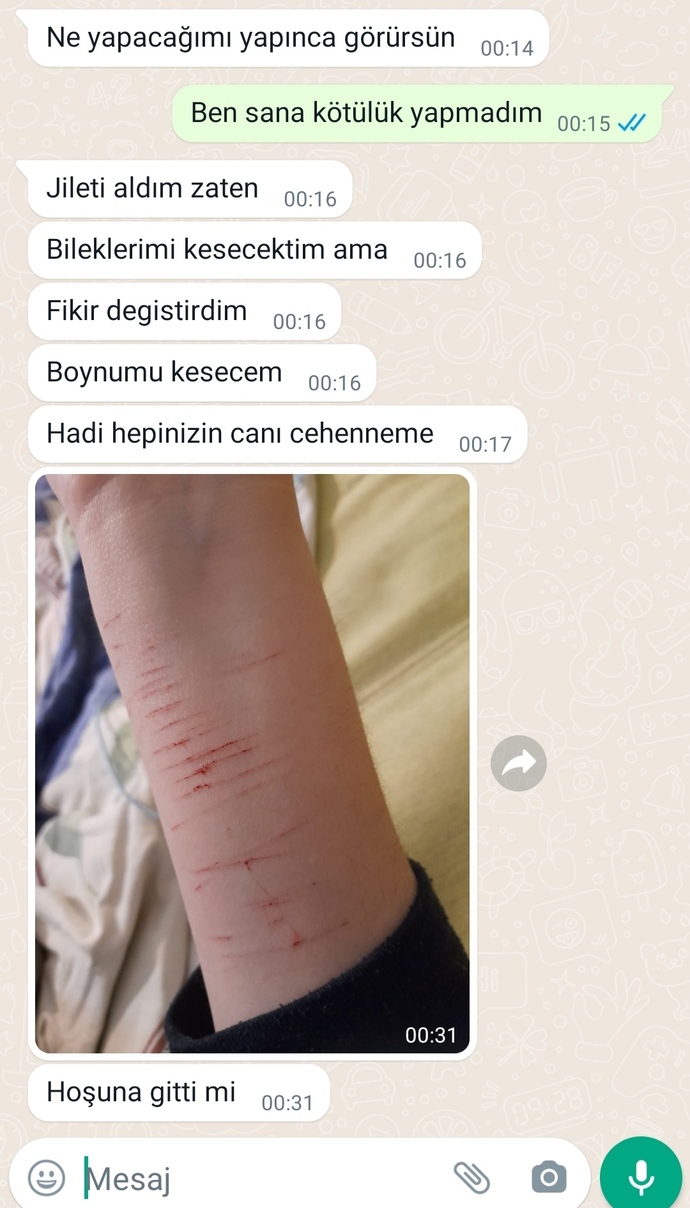 Sizce intihar eder mi? sizin için kendini kesenler ve intihar ederim yazanlar intihar ettiler mi? Bu konuda tecrübeniz var mı?