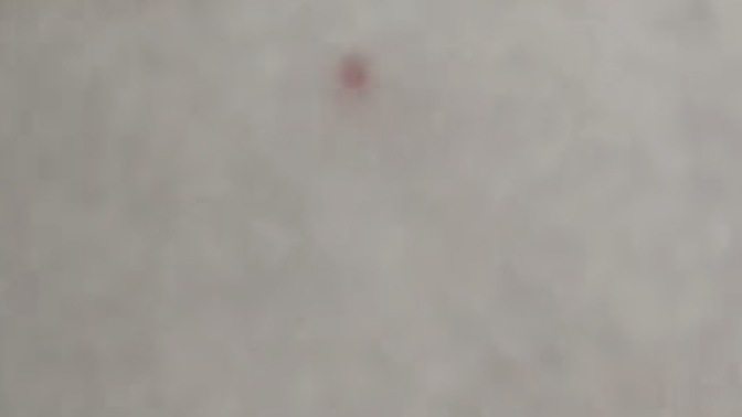 Bacagimda kirmizi bi leke cikti?