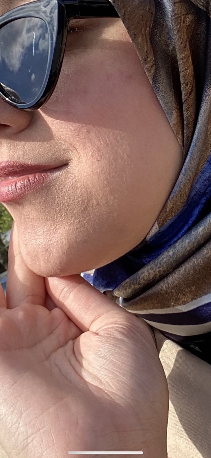 Cildim bebek gibiydi ya son birkaç gündür böyle, ne kullanabilirim sizce?