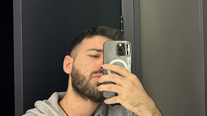 Yüzünde sivilce izi olan biri yakışıklı olamaz mı?