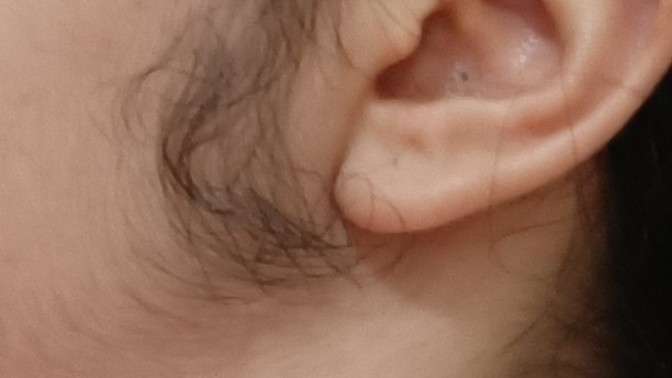 Kadınlarda favori kılları normal midir?
