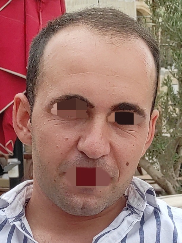 25 yaşında yaşlı görünüyorum. Nasıl bakım yapabilirim?