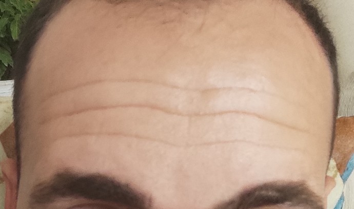 25 yaşında yaşlı görünüyorum. Nasıl bakım yapabilirim?