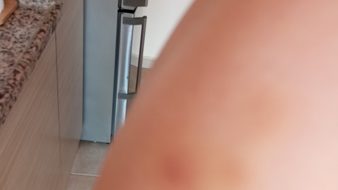 Günaydın, bir kaç gündür vücudumun çeşitli yerlerin de morarıklar oluyor bunun sebebi ne olabilir?