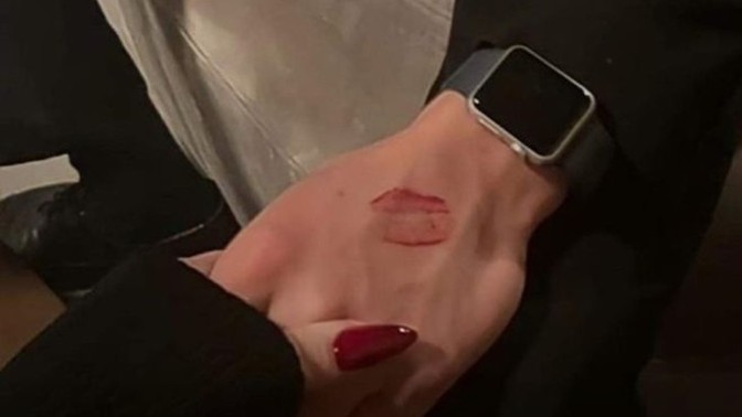 Hangi öpücük ne anlama geliyor? Sevgiliniz sizi nasıl öper ve sizdeki anlamı nedir?