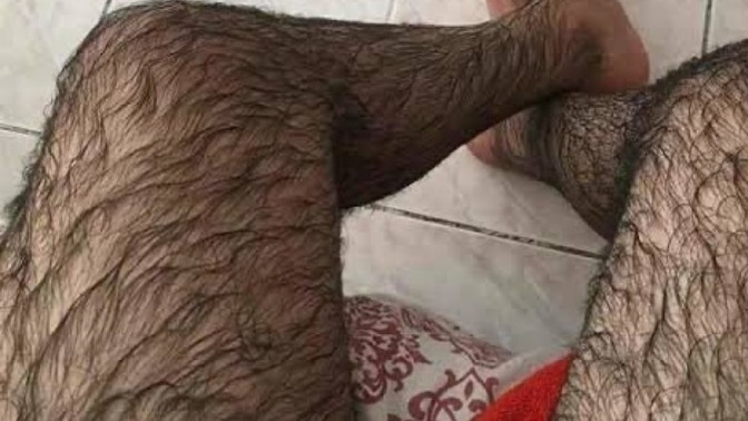 Bacağım abartılacak kadar kıllı mı?