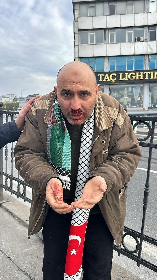 Arap bayrağı taşıyan adamın dayak yemesi hakkında ne düşünüyorsunuz?