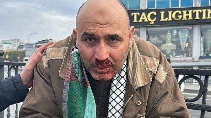 Arap bayrağı taşıyan adamın dayak yemesi hakkında ne düşünüyorsunuz?