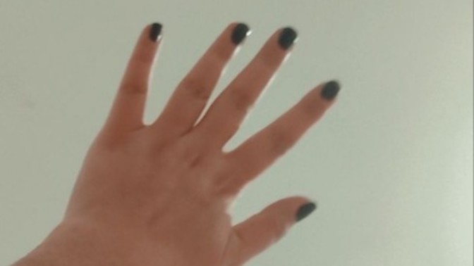 Elim kötü mü duruyor yoksa normal mi?