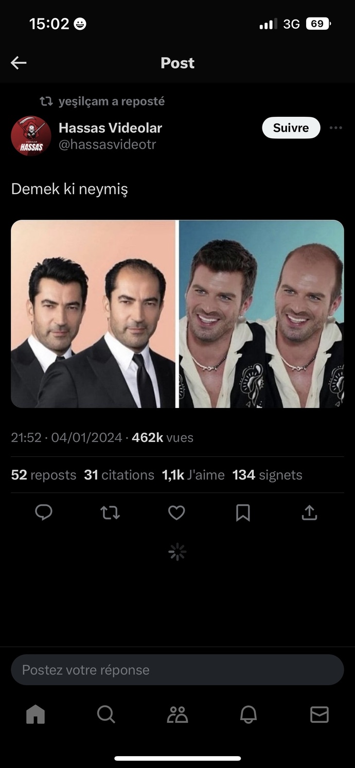 Erkekte saç, sakal olmadan güzelik olur mu?