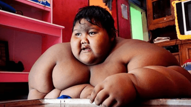 110cm boy ve 105 kilo olsaydınız ne yapardınız?