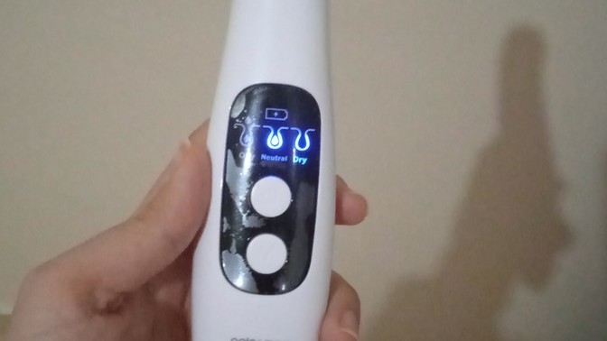 Teknolojik alettim patlayacak diye korkuyorum çözümü var mi?