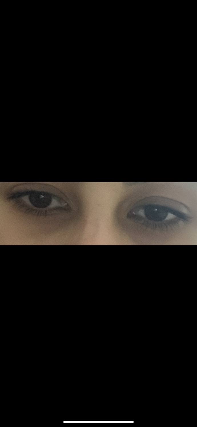 Gözaltlarıma bi bakar mısınız madde kullanıyorum gibi mosmor nasıl geçer?