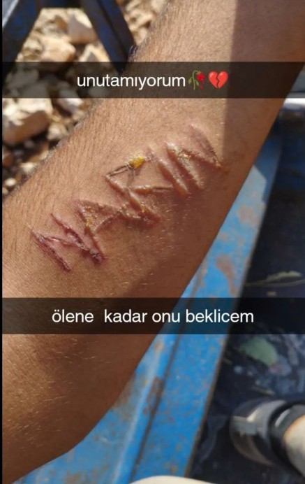 Sevdiğiniz ismini böyle koluna yazar mısınız?