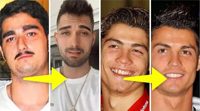 Ahanda içime sindim demek için kaç kilo estetik lazım?