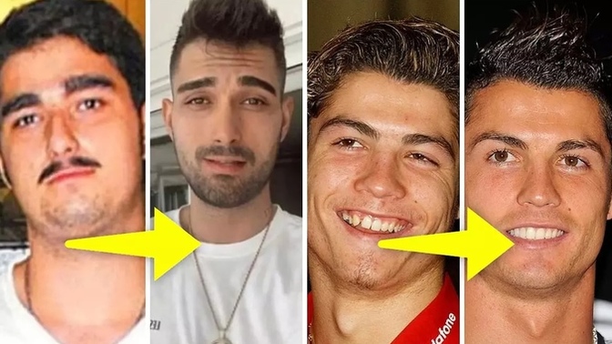 Ahanda içime sindim demek için kaç kilo estetik lazım?