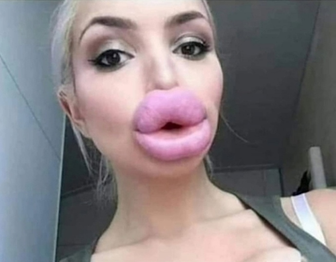 Sizi kocaman öpüyorummm 😂😂😂