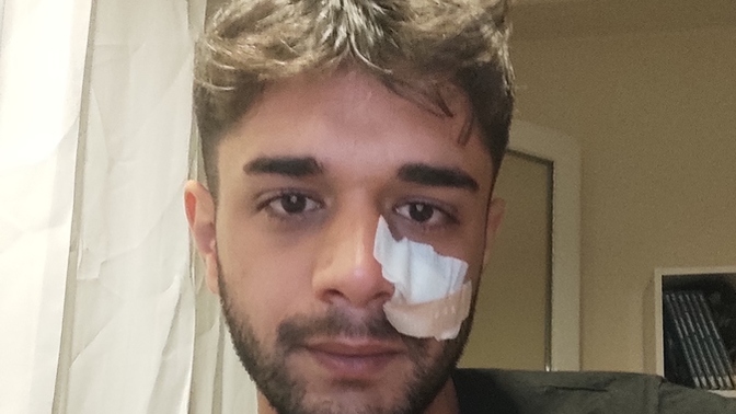 En son ne zaman kavga ettiniz ve dayak yediniz mi 😅?