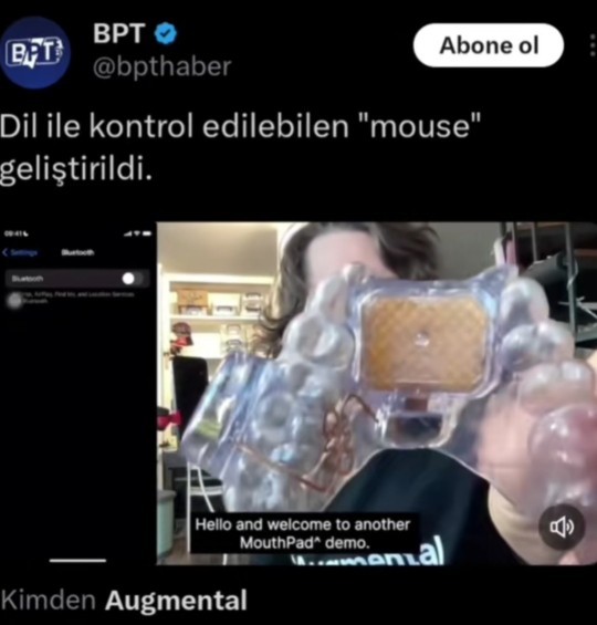 Ağız içinden dille kontrol edilen muouse geliştirildi! Ne düşünüyorsunuz?