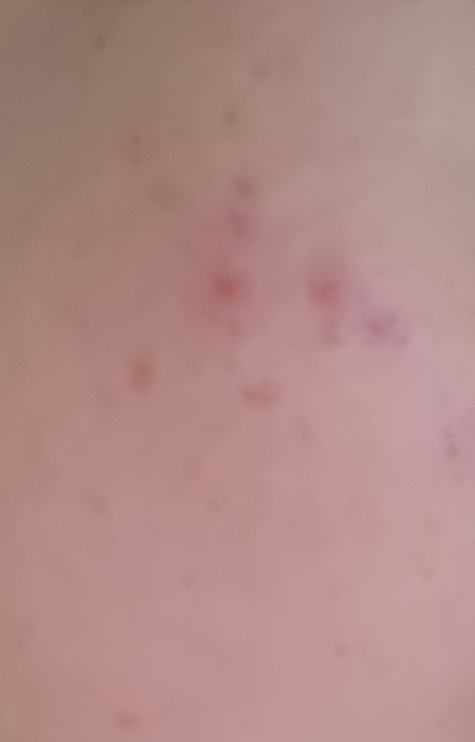 La roche posay yüz yıkama jelini kullanmaya başladım bunlar çıktıktan sonra ekstradan ne yapabilirim?