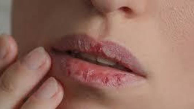 Aşırı dudak kuruluğu için önerebileceğiniz lip balm var mı?