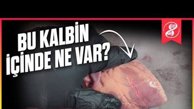 Merhaba millet eğer sevmek kalbe dokunmaksa gerçekten göğüsü açıp o kalbe dokunabilirsin?