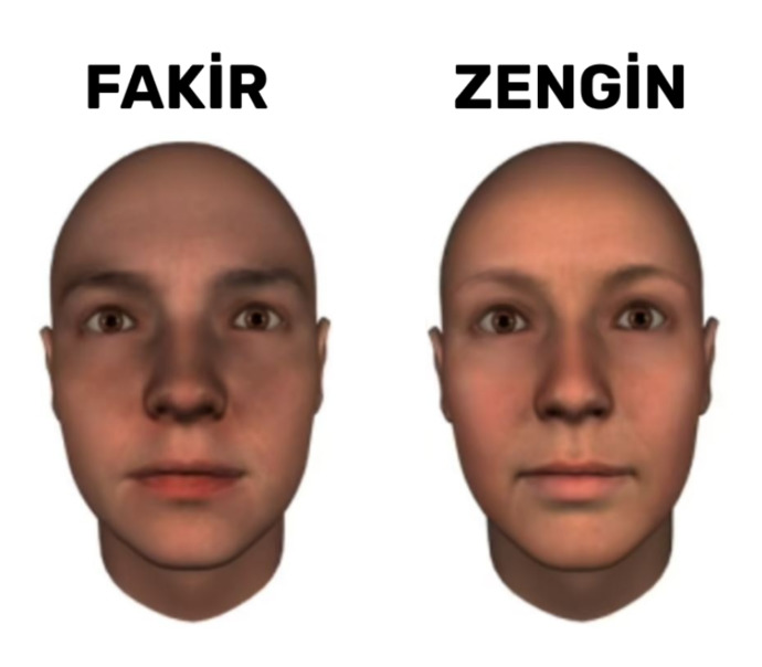 Glasgow Üniversitesi, doğuştan zengin ve doğuştan fakir yüz tipini belirledi. Siz bu yüz tipine göre zengin misiniz?