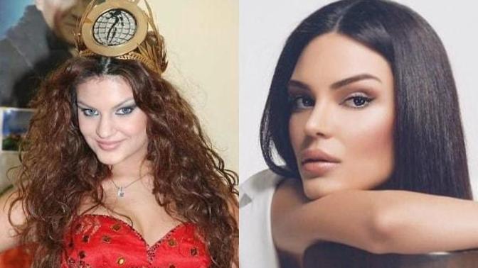 Erkekler neden doğal kız seviyorum deyip estetiklilerin peşinden koşarlar?