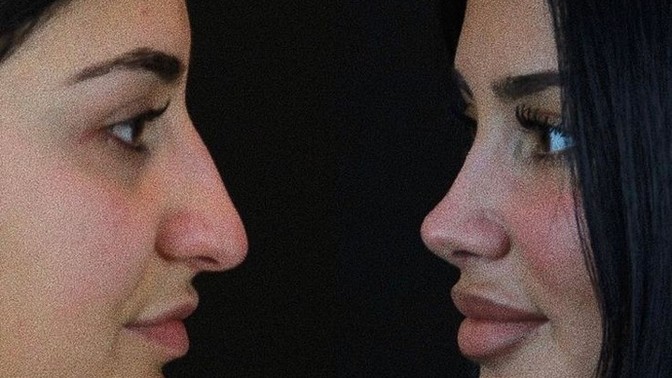 Estetik bir insanı değiştirir mi?