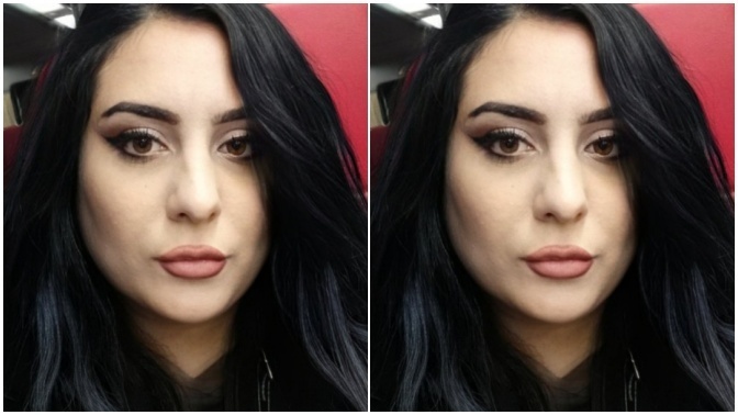 Yanaklarımda içine çökme, çukur gibi neden oluyor?