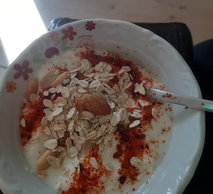 Kafam gözüm ağrıyo diye işe de gitmedim🤕