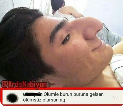 Burnum çok mu büyük?