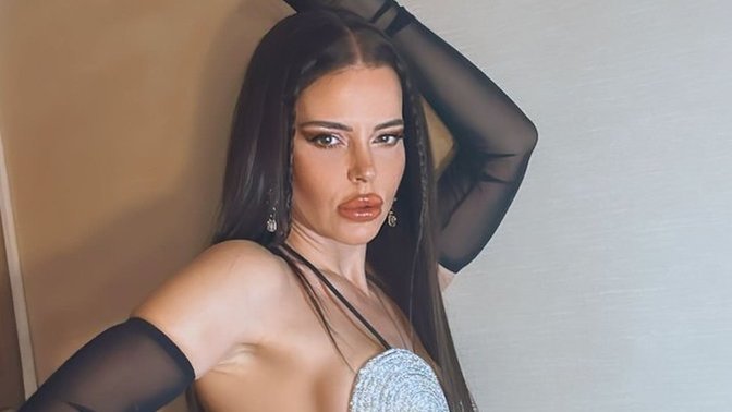 Estetik ameliyatı geçiren Simge Sağın’ın son hali; nasıl buldunuz?