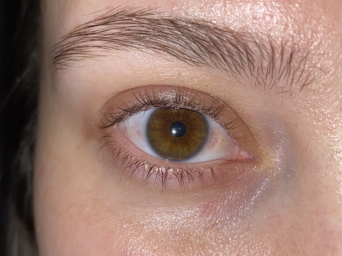 Kızlar göz altı kırışıklık ve morluklar için ne kullanıyorsunuz?