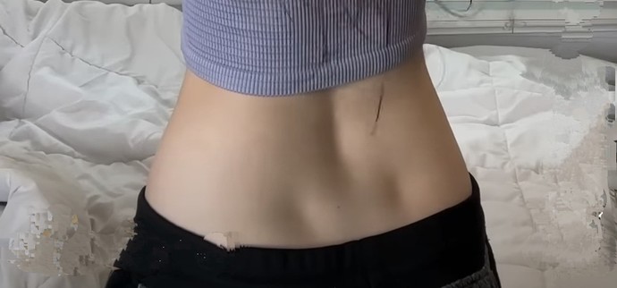 Belimdeki gamze mi oluyor?