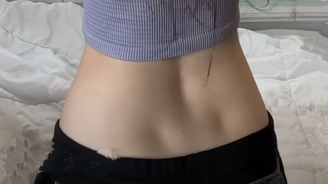 Belimdeki gamze mi oluyor?