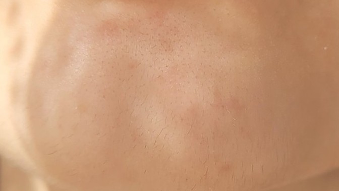 Çenemde sakal çıkıyor çok kötü duruyor mu sizce?