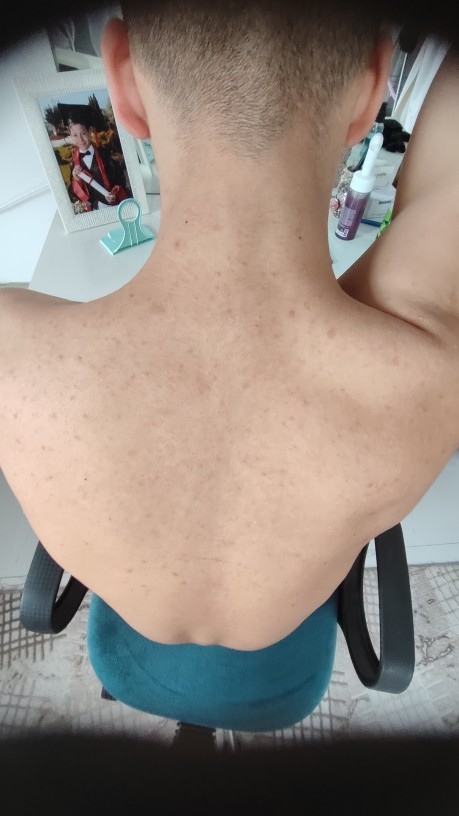 Acill destektt lazım?
