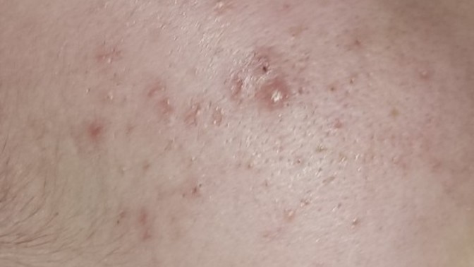 Sizce cildiye mi yoksa güzellik salonu mu?