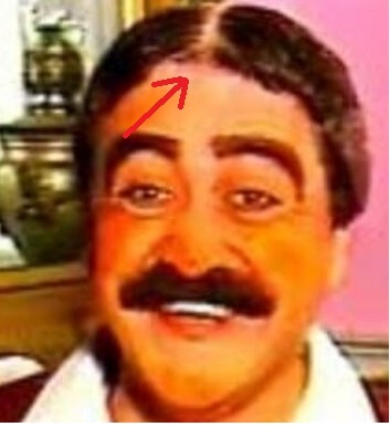 Özel bölgede kıl olması çok mu rahatsız ediyor?