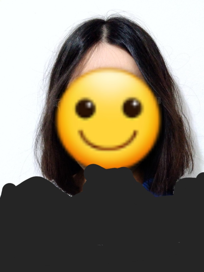 Saçımın arası çok mu açık?