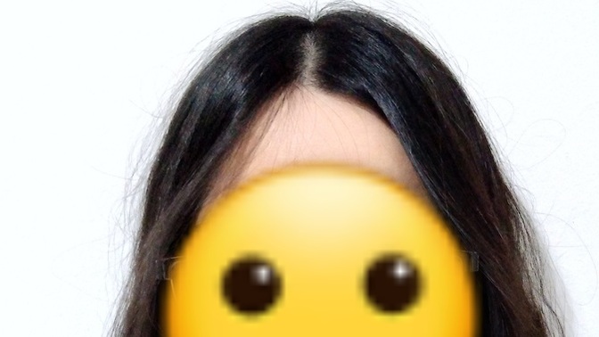 Saçımın arası çok mu açık?
