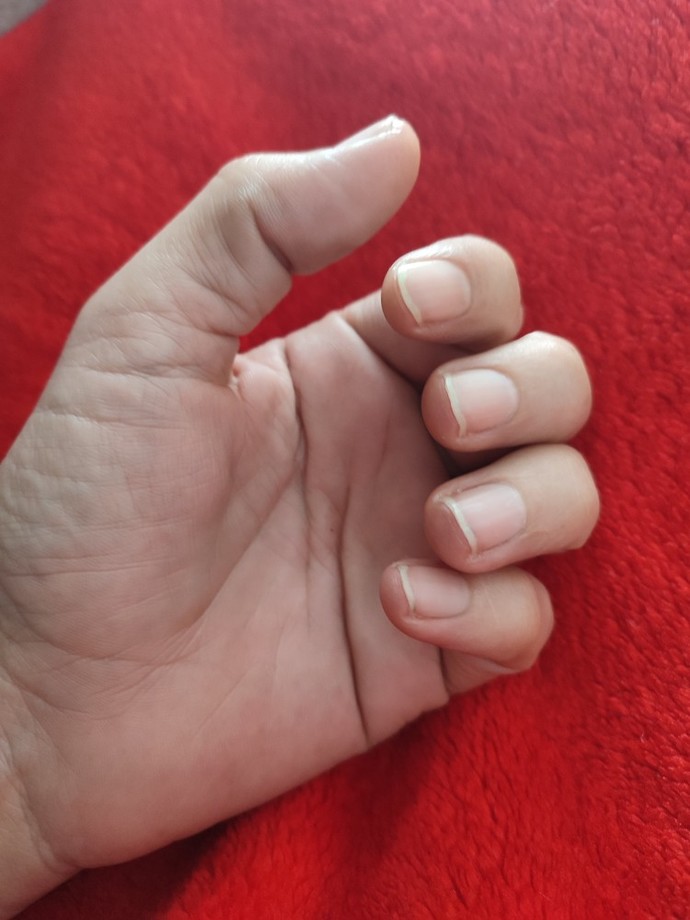 Tırnaklarınızı yiyor musunuz?