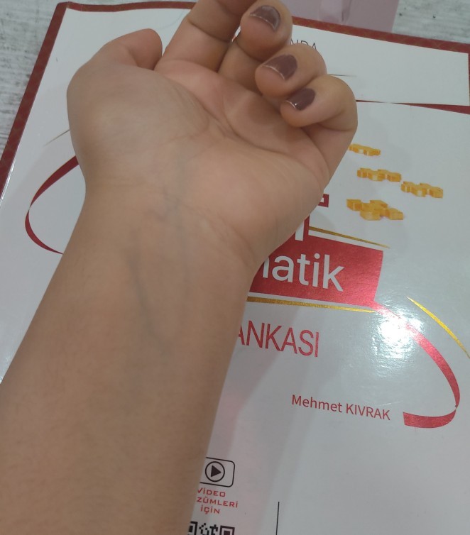 Damarlarımın bu kadar belli olması normal mi?