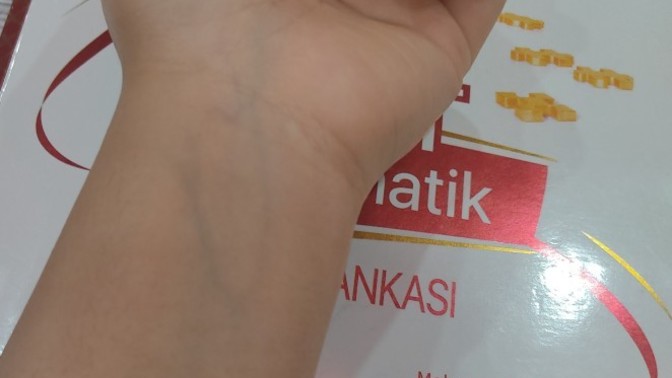 Damarlarımın bu kadar belli olması normal mi?