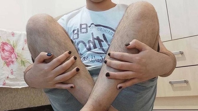 Erkeklere oje yakışıyor mu?