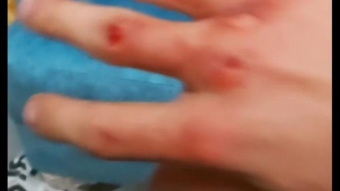 Kavga ettim elim nasıl geçer?